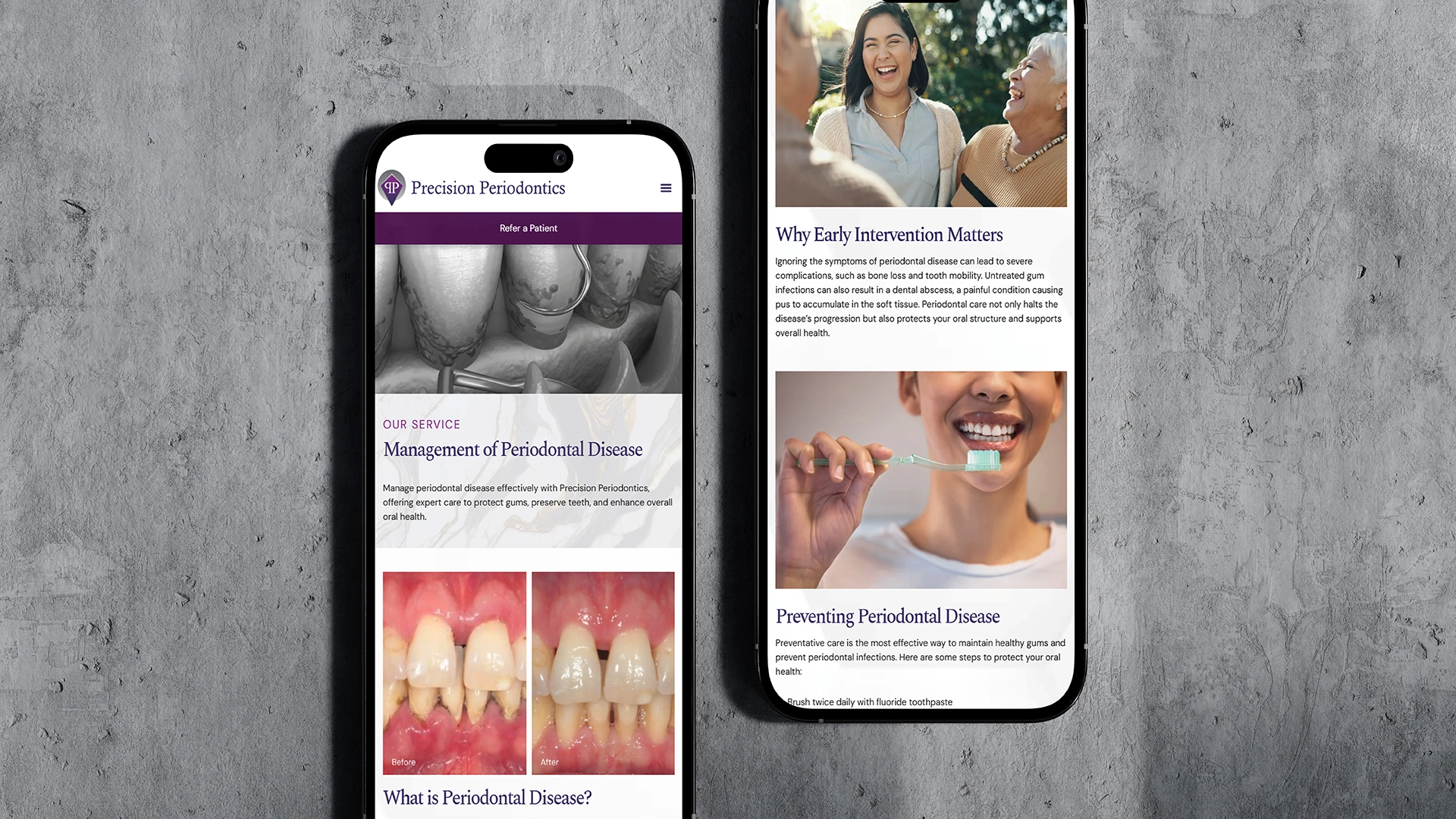 Precision Perdiodontic Portfolio rollout9