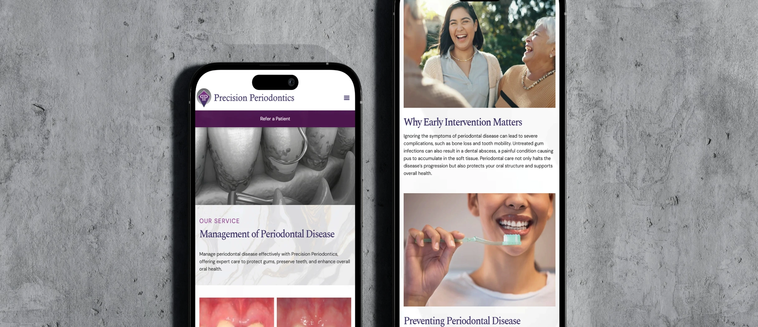 Precision Periodontics marketing shown on two phones